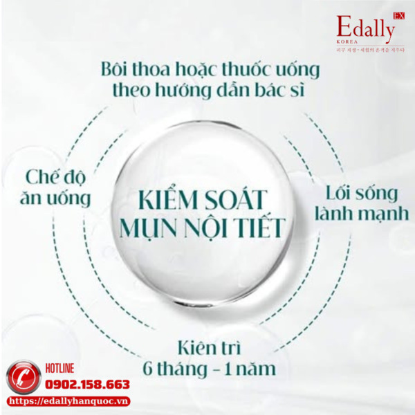 Cách kiểm soát mụn nội tiết hiệu quả