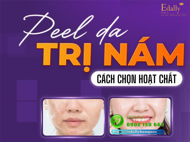 Cách lựa chọn hoạt chất peel cho da nám