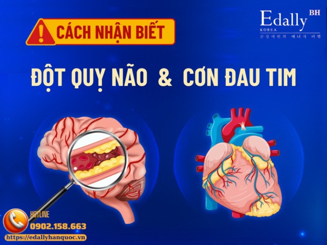 Cách nhận biết cơn đau tim hoặc đột quỵ não