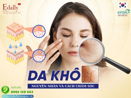 Cách Nhận Biết Da Khô Và Hướng Chăm Sóc Hiệu Quả Để Da Luôn Mịn Màng