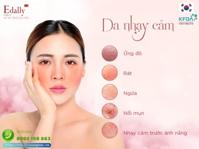 Cách nhận biết da đang bị nhạy cảm