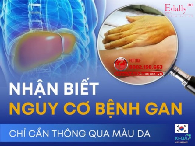 Cách nhận biết nguy cơ bệnh gan chỉ cần thông qua màu da