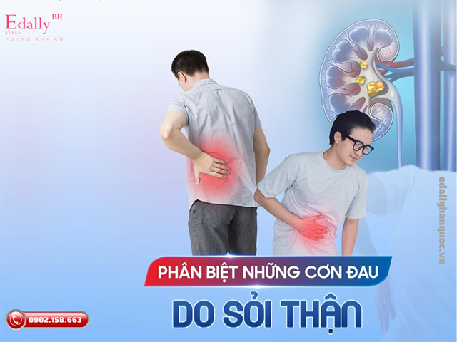 Cách nhận biết và phân biệt đau lưng do sỏi thận và đau lưng thông thường