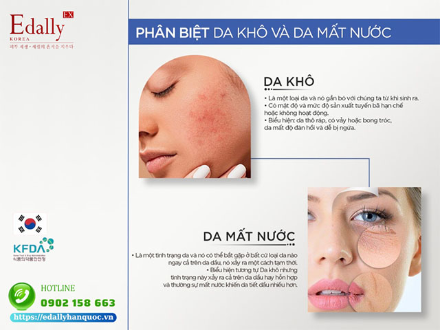 Cách phân biệt da khô và da mất nước