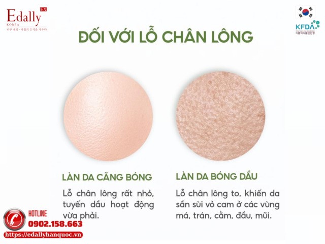 Cách phân biệt làn da căng bóng và làn da bóng dầu dựa vào lỗ chân lông