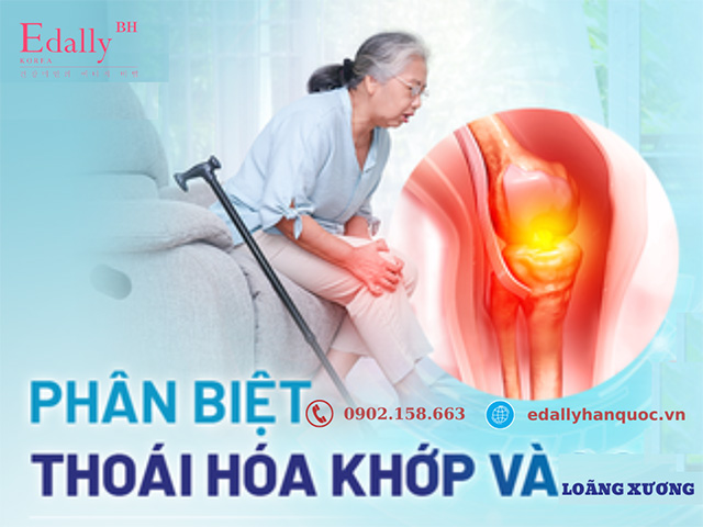 Cách phân biệt thoái hóa khớp và loãng xương