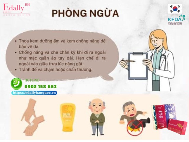 Cách phòng ngừa ban xuất huyết ở người già như thế nào?