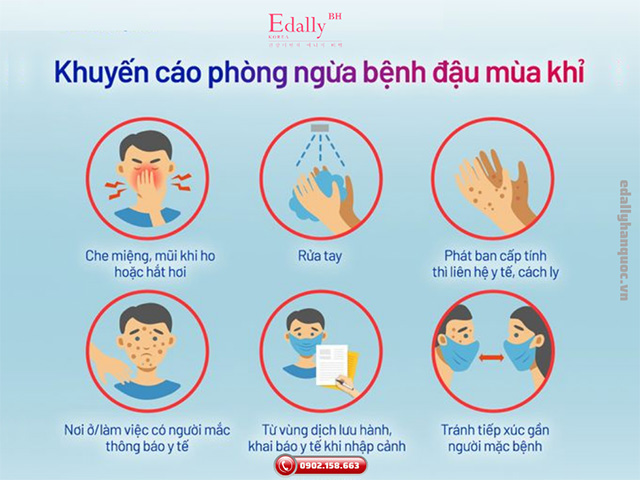 Khuyến cáo cách phòng ngừa bệnh đậu mùa khỉ