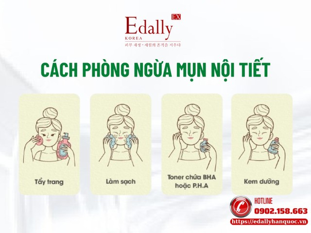Cách phòng ngừa mụn nội tiết