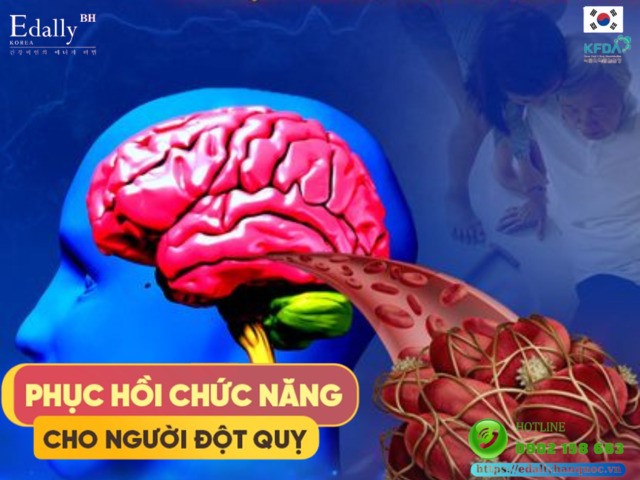 Cách phục hồi chức năng cho người bị đột quỵ