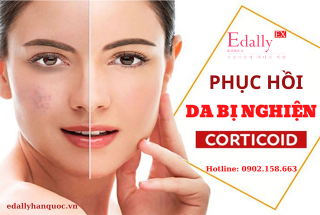 Cách phục hồi làn da bị nghiện Corticoid như thế nào?