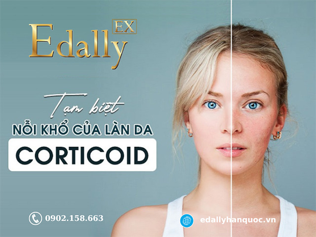 Cách phục hồi làn da bị nhiễm Corticoid