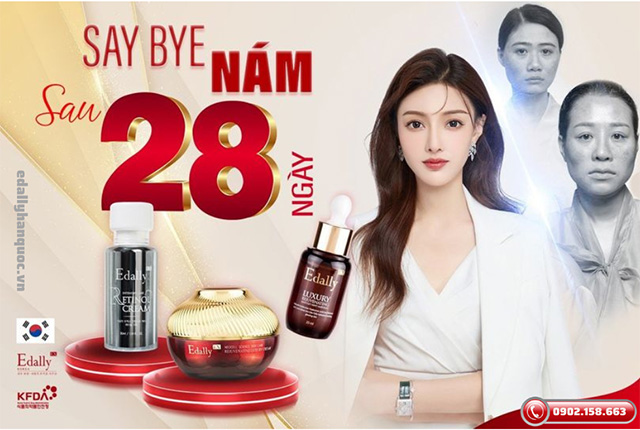 Cách say bye nám da sau 28 ngày với Bộ 3 Mỹ phẩm Edally EX Hàn Quốc