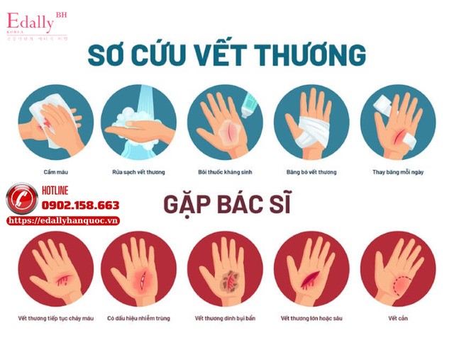 Hướng dẫn xử trí vết thương tại nhà và khi nào cần hỗ trợ y tế
