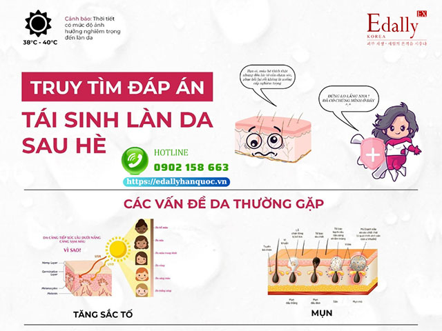 Cách tái sinh phục hồi làn da tăng sắc tố và mụn sau hè