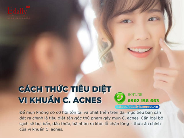 Cách tiêu diệt vi khuẩn gây mụn P.acnes/ C.acnes