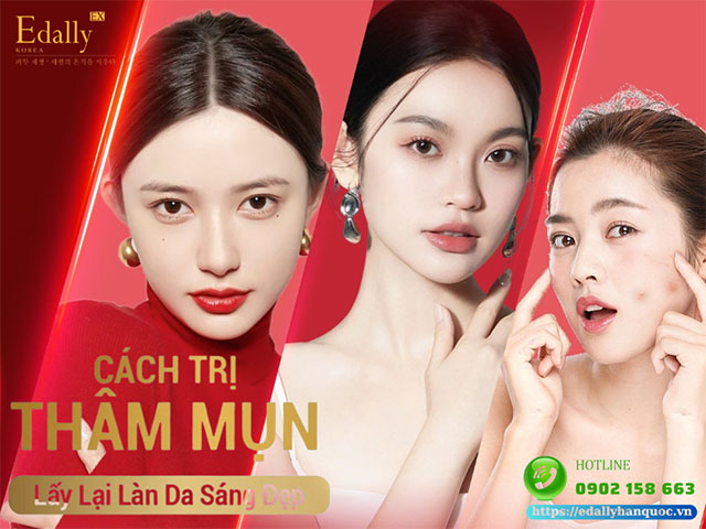 Cách điều trị dứt điểm thâm mụn - Lấy lại làn da trắng sáng