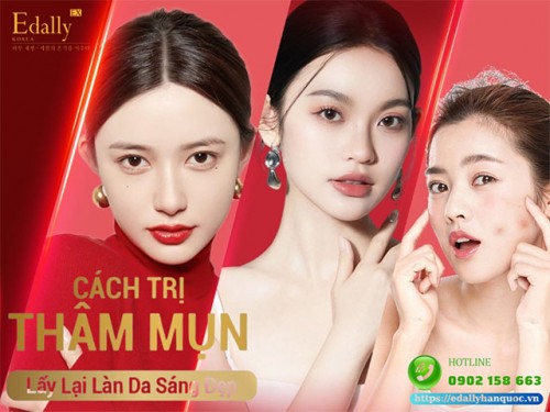 Làm Sao Để Điều Trị Dứt Điểm Thâm Mụn?