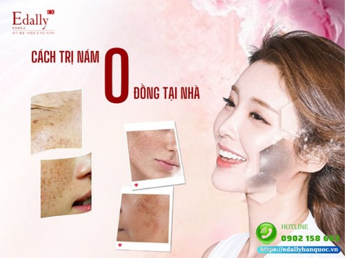 Cách Trị Nám Dứt Điểm Với Chi Phí 0 Đồng Ngay Tại Nhà