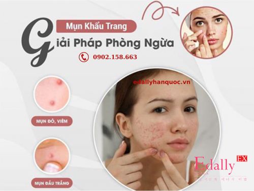 Nổi Mụn Do Đeo Khẩu Trang - Nguyên Nhân Và Cách Điều Trị