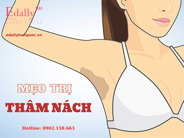 Cách chữa trị thâm nách tại nhà nhanh nhất