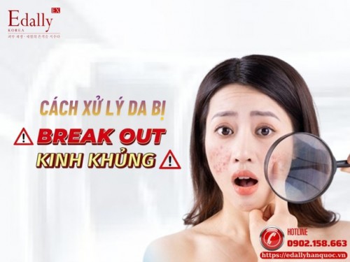 Cách Xử Lý Da Bị Break Out Hiệu Quả Và An Toàn