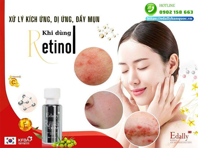 Cách xử lý bị kích ứng, dị ứng, đẩy mụn (purging) khi sử dụng Retinol như thế nào?