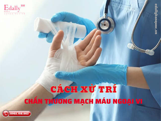 Cách xử trí chấn thương mạch máu ngoại vi