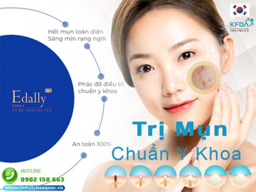 Cẩm Nang Xử Lý Các Loại Mụn Tại Nhà An Toàn, Hiệu Quả 