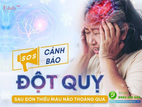 Cảnh Báo Về Những Cơn Đột Quỵ Nhỏ