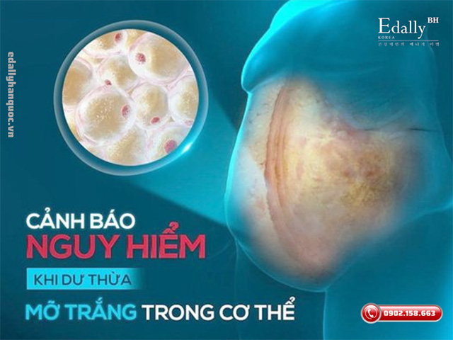 Sự nguy hiểm của việc dư thừa mỡ nội tạng trong cơ thể là gì?