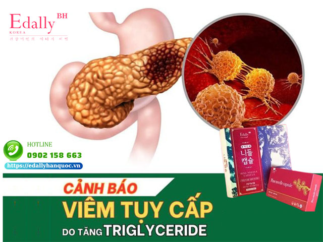 Cảnh báo biến chứng viêm tuỵ cấp khi để chỉ số triglyceride trong máu tăng cao vượt ngưỡng