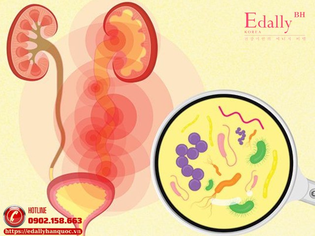 Cảnh giác với các vấn đề tiết niệu để tránh biến chứng nguy hiểm