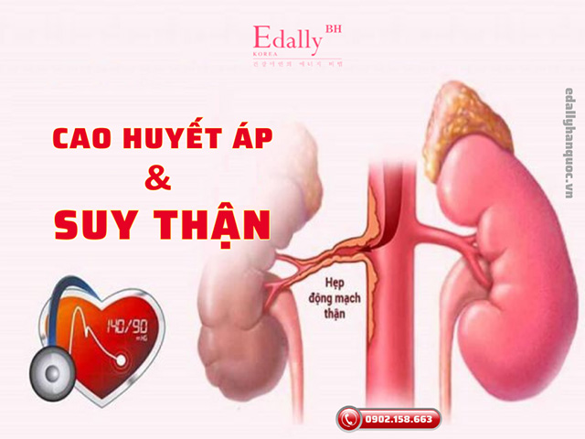 Cao huyết áp và suy thận - Một vòng luẩn quẩn trói chặt người bệnh