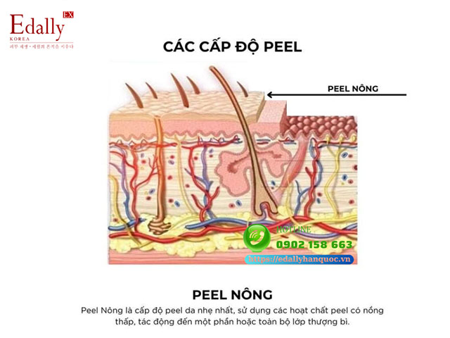 Cấp độ peel da nông