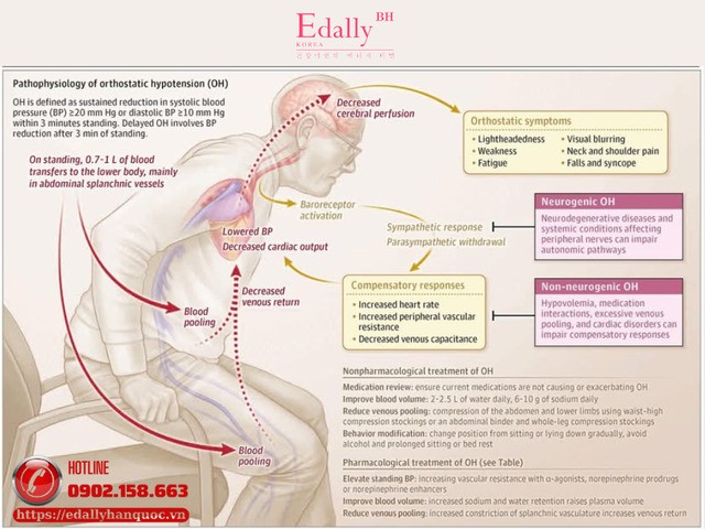 Cập nhật hạ huyết áp tư thế mới nhất từ Jama 2026