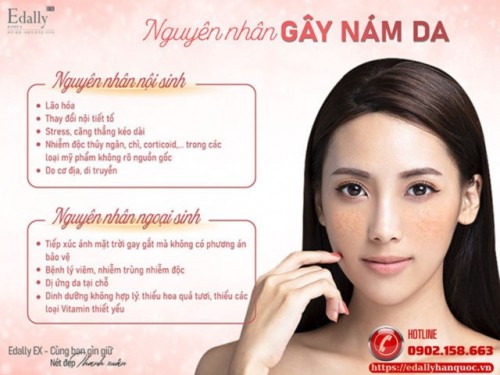 Sinh Bệnh Học Của Nám Da