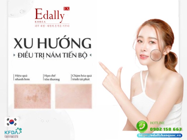 Cập nhật xu hướng điều trị nám tiến bộ trong 5 năm tới