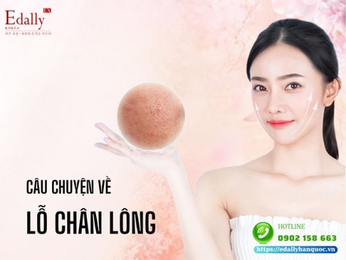 Câu Chuyện Về Lỗ Chân Lông Và Cách Để Thu Nhỏ Lỗ Chân Lông 