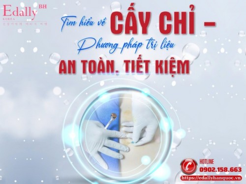 Cấy Chỉ Điều Trị: Hiểu Đúng Để Ứng Dụng An Toàn Và Hiệu Quả