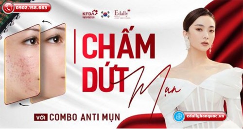 Combo Anti Mụn Edally EX - Chấm Dứt Lỗi Lo Về Mụn