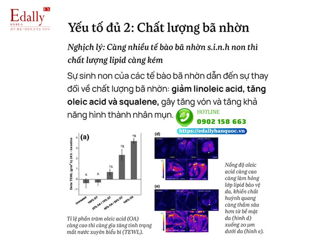 Yếu tố chất lượng bã nhờn và việc kiềm dầu, giảm mụn