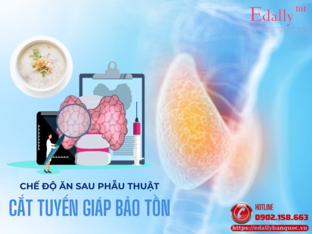 Chế Độ Ăn Sau Phẫu Thuật Cắt Tuyến Giáp Bảo Tồn