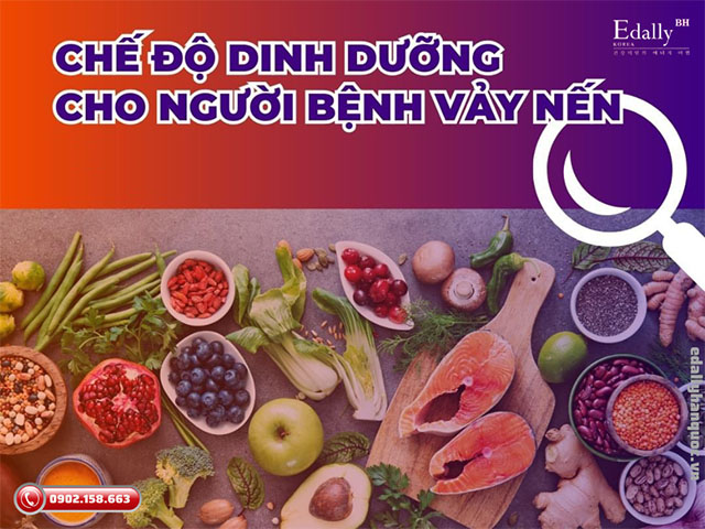 Chế độ dinh dưỡng hợp lý dành cho người bệnh vảy nến giúp kiểm soát bệnh tốt hơn