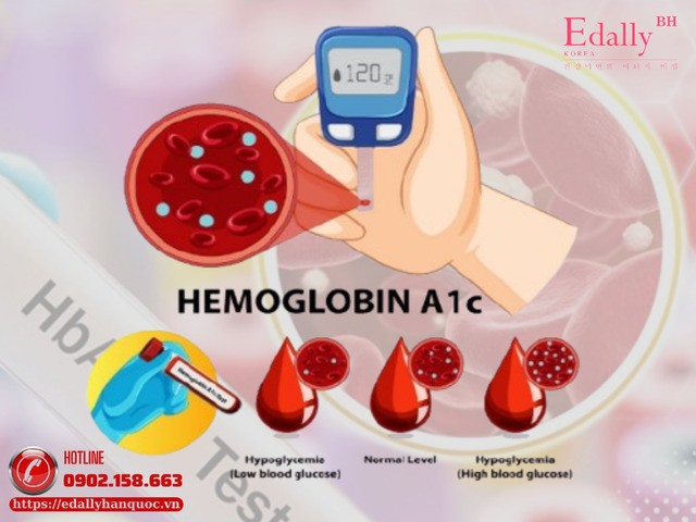 Chỉ số HbA1c là gì và đọc sao cho đúng?
