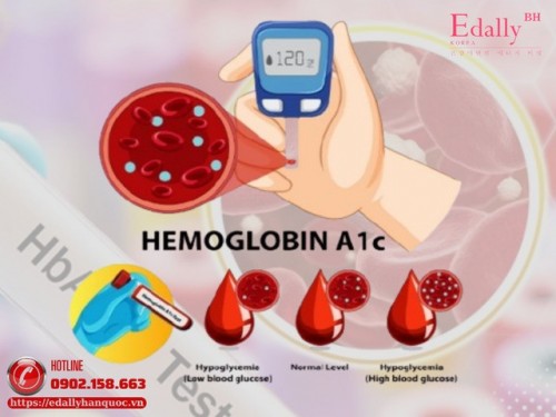 Chỉ số HbA1c Là Gì Và Đọc Sao Cho Đúng? Chỉ số HbA1c Là Gì Và Đọc Sao Cho Đúng?