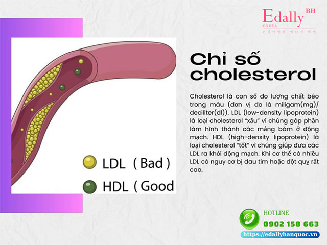 Theo dõi chỉ số cholesterol trong cơ thể để có một sức khỏe tốt