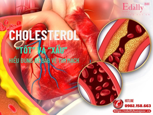 Cholesterol tốt và Cholesterol xấu: Hiểu đúng để bảo vệ tim mạch