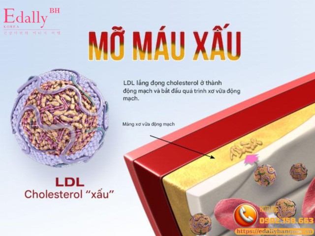 Cholesterol xấu (LDL-cholesterol) hay còn gọi là mỡ máu xấu nguy hiểm như thế nào?