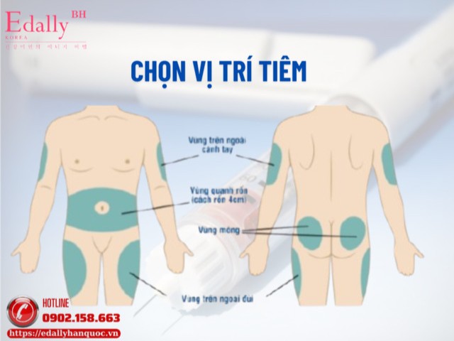 Hướng dẫn cách chọn vị trí tiêm insulin tại nhà